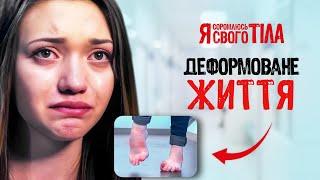 Детская особенность стала фатальной – Я соромлюсь свого тіла | ЗДОРОВЬЕ | МЕДИЦИНА | ЛЕЧЕНИЕ