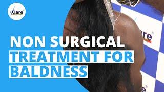 Permanent Solution For Advanced Stage Of Baldness