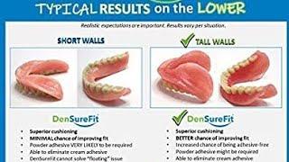 DENSUREFIT SOFT RELINE Bottom Denture!!!! #densurefit #denturewearers  #dentures