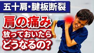 【五十肩・腱板断裂の特徴を解説！】肩の痛み放っておいたらどうなるの？