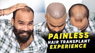 Hair Transplant in Kota | Best Results & Cost of Hair Transplant in Kota