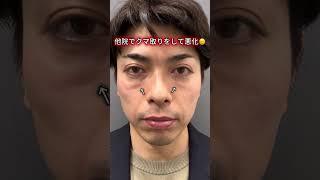 寝不足・疲れ顔は1時間あれば解消できます！！！ #東京美容外科#目元整形 #目の下のクマ