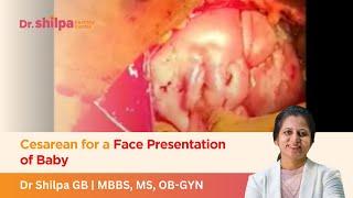 Cesarean for a Face Presentation of Baby | Dr Shilpa G B