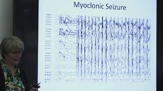 SLC13A5 Clinical Spectrum with Dr. Brenda Porter - SLC13A5 Research Roundtable 2018