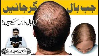 BAAL GIRNA BAND - No HAIR FALL - Dr. Fahad Artani Roshniwala