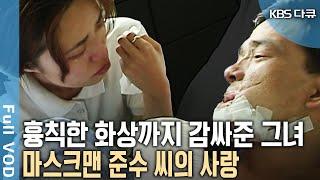 남들과 다른 얼굴 화상까지 보듬어준 그녀를 위해 앞으로의 시간들을 함께 하기로 했다! | 마스크맨 준수 씨의 사랑 | 병원 24시 | KBS 20010706 방송