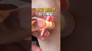 모기 물리면 당황하지 말고 당기세요.