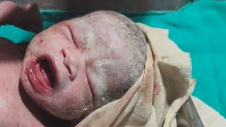 31 may 2025  4.35 am Emotional Newborn Birth | First Breath and Cry"