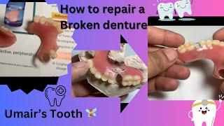 How to repair a broken denture#dental#youtube#umair tooth fairy #dentistry @Umairazeem8553