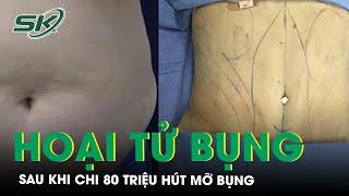 Chi 80 triệu làm đẹp, người phụ nữ hoại tử bụng sau khi hút mỡ  | SKĐS