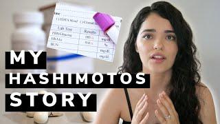 MY HASHIMTOS STORY! | ANXIETY, DEPRESSION, WEIGHT GAIN, JOINT PAIN!? NATURAL APPROACH?!