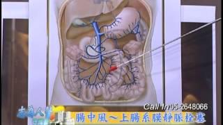 【志為人醫守護愛】20131114 - 腸中風 上腸系膜靜脈栓塞