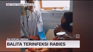 Waspada Rabies, Balita Terinfeksi Rabies