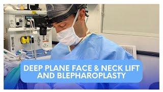 Deep Plane Face & Neck Lift with Dr. Zuri in Miami | Zuri Plastic Surgery