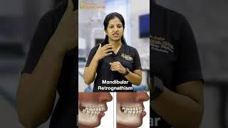 Dr. Dhivya Dilipkumar Explains Mandibular Retrognathism: Causes, Symptoms, and Treatment Options