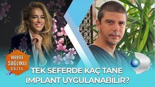 TEK SEFERDE KAÇ TANE İMPLANT UYGULANABİLİR? DR  TANSU ERAKMAN