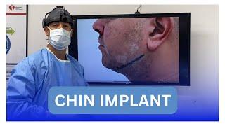 Chin implant procedure with Dr. Zuri in Miami  | Zuri Plastic Surgery