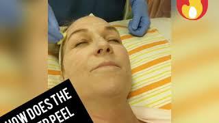 3 Step Peel by ZO Skin Health at Dr Wendy Ng Plastic Surgery