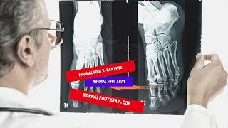 16 Normal Foot X Ray Views