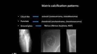 Bone lesions