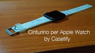 Cinturino Casetify per Apple Watch by TimesGadget