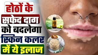 Lip vitiligo skin disease treatment | How to reduce genetic lip pigmentation