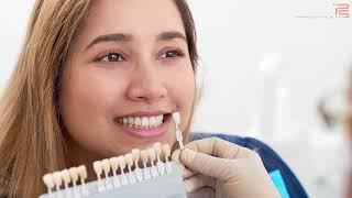 Perfect Smile Spa Dental Veneers