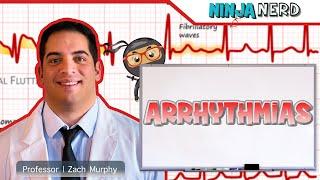 Arrhythmias | Clinical Medicine