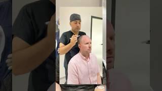 Mr. Cassidy's Transplant Process I DRKAYA #haartransplant #hairtransplantturkey #saçdoktoru