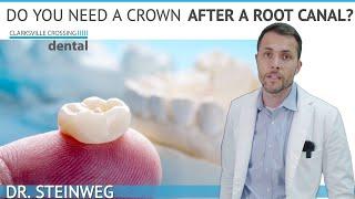 Do I Need Dental Crown After A Root Canal? 