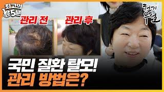 [최고의 5분_천기누설] 성인 3명 중 1명인 국민 질환 탈모! 극복 방법은?