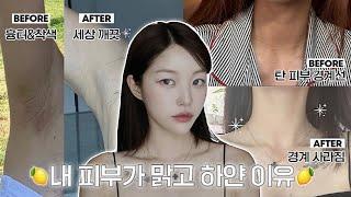 (eng) 언니 피부 어떻게 하얘졌어요? + 찐으로 효과본 미백템들, 겨드랑이 착색 관리템, 탄 피부 되돌리는 법 | 소윤Soyoon