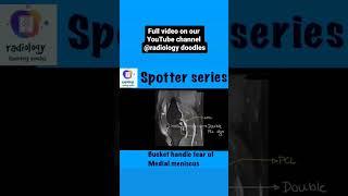 Spotter series on our YouTube channel #radiology #spotters #mri #xray