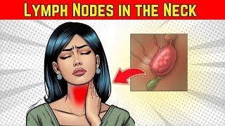 Lymph Nodes in the Neck: What Does It Mean?