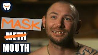 How wearing a mask could cause oral health concerns