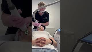 AviClear laser acne treatment demo at Quinn Clinics Bristol