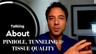 The Pinhole surgical technique, tunneling & tissue quality