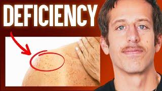 The #1 Deficiency Behind Aging! (Spot & Treat This ASAP) | Ben Azadi