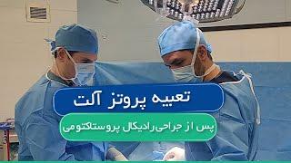 تعبیه پروتز آلت پس از جراحی رادیکال پروستاکتومی