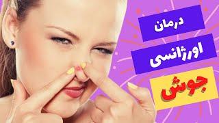 درمان فوری جوش صورت / درمان سریع جوش با ماسک خانگی و روش طب سنتی /رفع کامل جوش و جای جوش