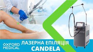 Лазерна епіляція CANDELA. Переваги Александритового лазера GentleLASE