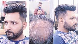 8929576395, 8882017181 non surgical hair replacement for men  by master RIZY