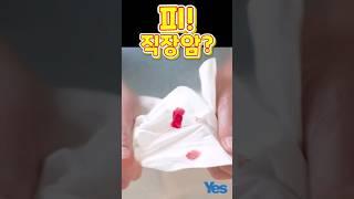 항문에서 피가? 혹시 직장암? part1