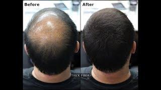 THICK FIBER |  Hair Building Fibers is a hair loss concealer fiber. Cover up Bald patches