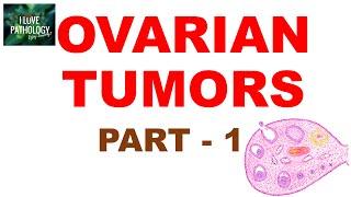 OVARIAN TUMORS -  Part 1 : Classification