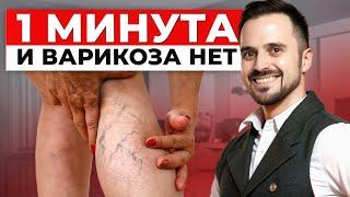 СЕКРЕТ, который скрывают врачи! / ЛУЧШЕЕ упражнение против ВАРИКОЗА