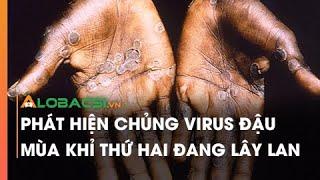 Phát hiện chủng virus đậu mùa khỉ thứ hai đang lây lan
