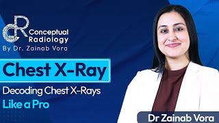 Decoding Chest X-Ray Like a Pro with Dr. Zainab Vora | Conceptual Radiology