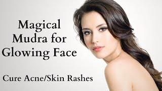 Magical Mudra for Glowing Face | Cure for Acne | Cure for Skin Rashes