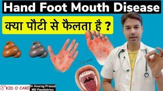 कैसे फैलता है HFM (Spread / Transmission of Hand Foot Mouth) Disease: Dr Anurag Prasad (Hindi)